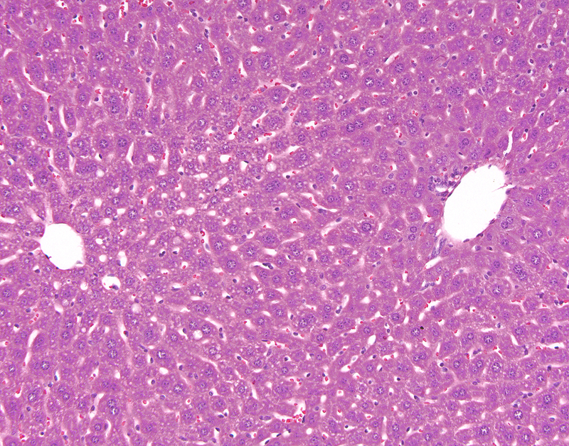 Routine Histology And Immunohistochemistry Ta Ucsf Liver Center